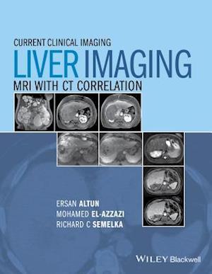 Liver Imaging – MRI with CT Correlation