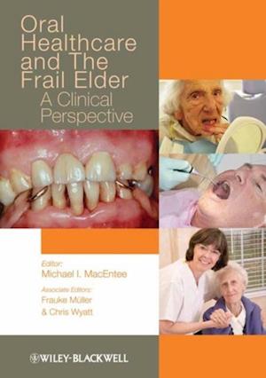 Oral Healthcare and the Frail Elder