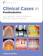 Clinical Cases in Prosthodontics