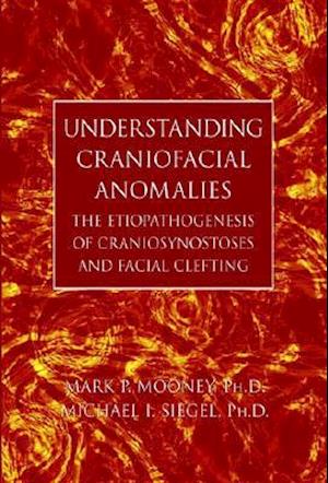 Understanding Craniofacial Anomalies