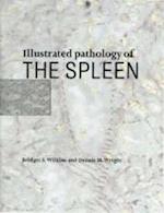 Illustrated Pathology of the Spleen