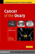 Cancer of the Ovary