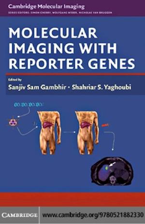 Molecular Imaging with Reporter Genes