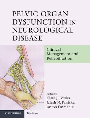 Pelvic Organ Dysfunction in Neurological Disease