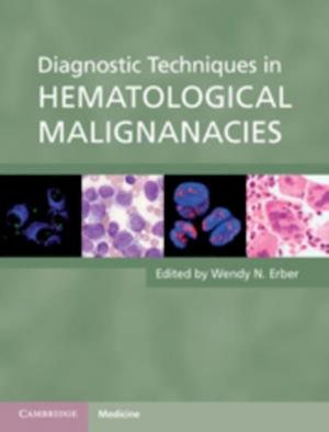 Diagnostic Techniques in Hematological Malignancies