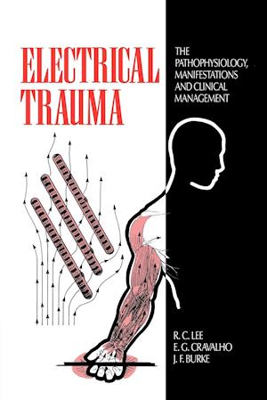 Electrical Trauma
