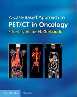 A Case-Based Approach to PET/CT in Oncology