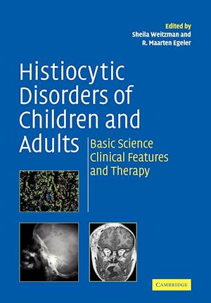 Histiocytic Disorders of Children and Adults