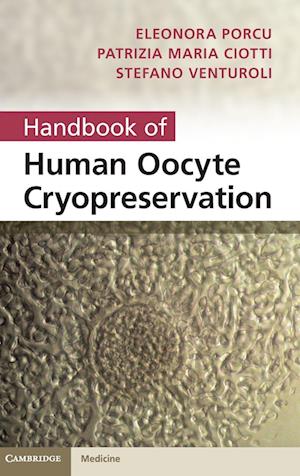 Handbook of Human Oocyte Cryopreservation