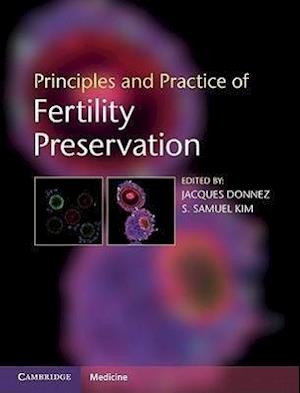 Principles and Practice of Fertility Preservation