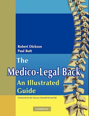 The Medico-Legal Back: An Illustrated Guide