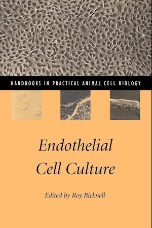 Endothelial Cell Culture