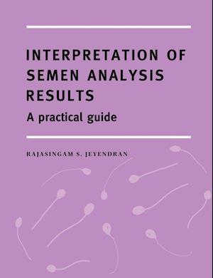 Interpretation of Semen Analysis Results