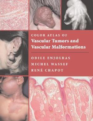 Color Atlas of Vascular Tumors and Vascular Malformations