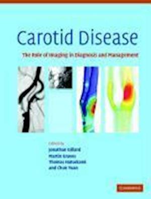 Carotid Disease