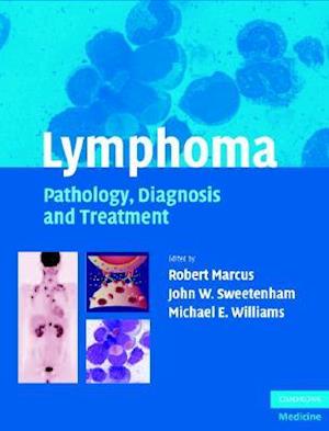 Lymphoma