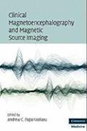 Clinical Magnetoencephalography and Magnetic Source Imaging