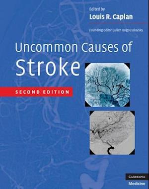 Uncommon Causes of Stroke