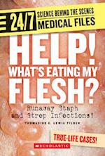 Help! Whats Eating My Flesh?