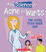 The Science of Acne and Warts