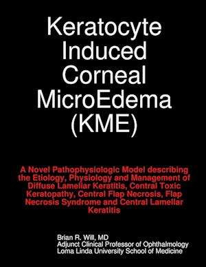 Keratocyte Induced Corneal MicroEdema