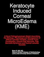 Keratocyte Induced Corneal MicroEdema 