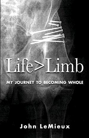 Life is Greater Than Limb: My Journey to Becoming Whole