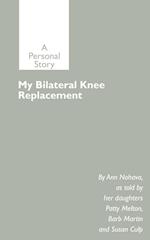 My Bilateral Knee Replacement