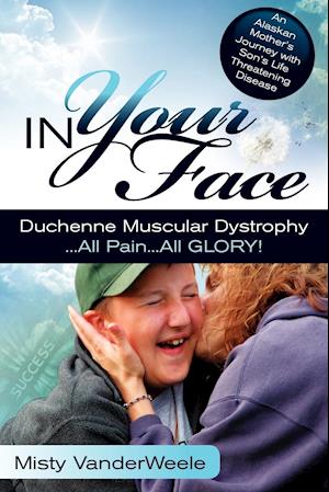 In Your Face Duchenne Muscular Dystrophy All Pain All Glory