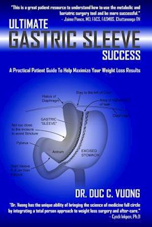 Ultimate Gastric Sleeve Success