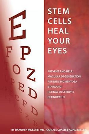 Stem Cells Heal Your Eyes