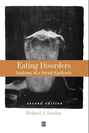 Eating Disorders – Anatomy of a Social Epidemic 2e