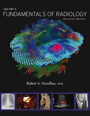 Squire’s Fundamentals of Radiology