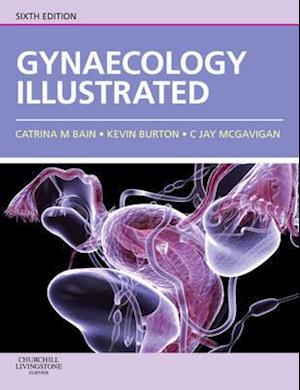 Gynaecology Illustrated