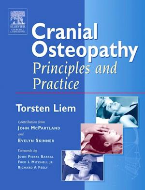 Cranial Osteopathy