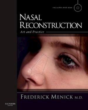 Nasal Reconstruction: Art and Practice