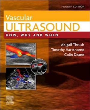 Vascular Ultrasound