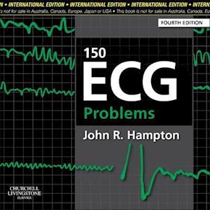 150 ECG Problems, International Edition