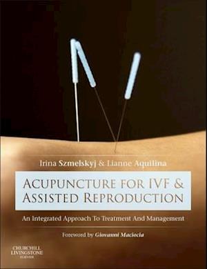 Acupuncture for IVF and Assisted Reproduction