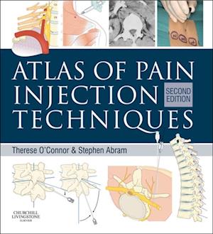 Atlas of Pain Injection Techniques