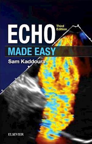 Echo Made Easy