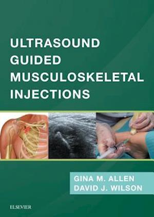 Ultrasound Guided Musculoskeletal Injections