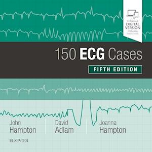 150 ECG Cases