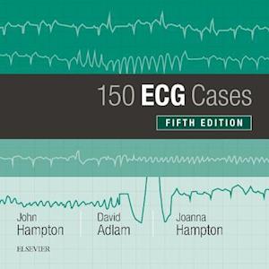 150 ECG Cases