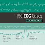 150 ECG Cases