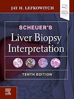 Scheuer's Liver Biopsy Interpretation