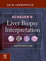 Scheuer's Liver Biopsy Interpretation E-Book