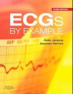 ECGs by Example