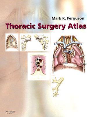 Thoracic Surgery Atlas