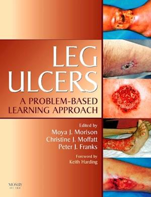 Leg Ulcers E-Book